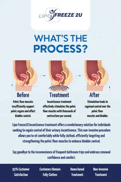 Diagram of how incontinence treatment Sandy works.